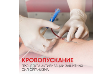 Венозное кровопускание от гипертонии — Алматы | Прием врача-хирурга | 10 000 тг