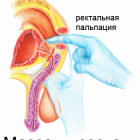 Урологический массаж. Профилактика мужских заболеваний после 40 лет