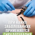 Гирудотерапия в Алматы от опытного врача гирудотерапевта женщины